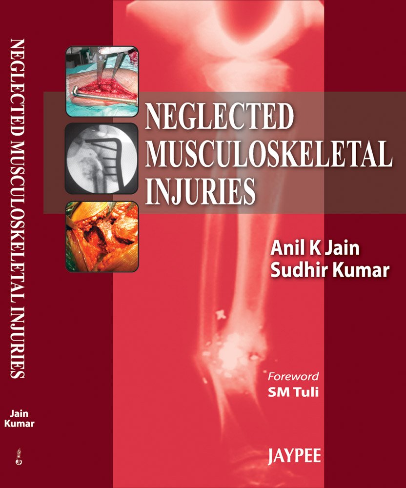 neglected musculoskeletal injuries 2011