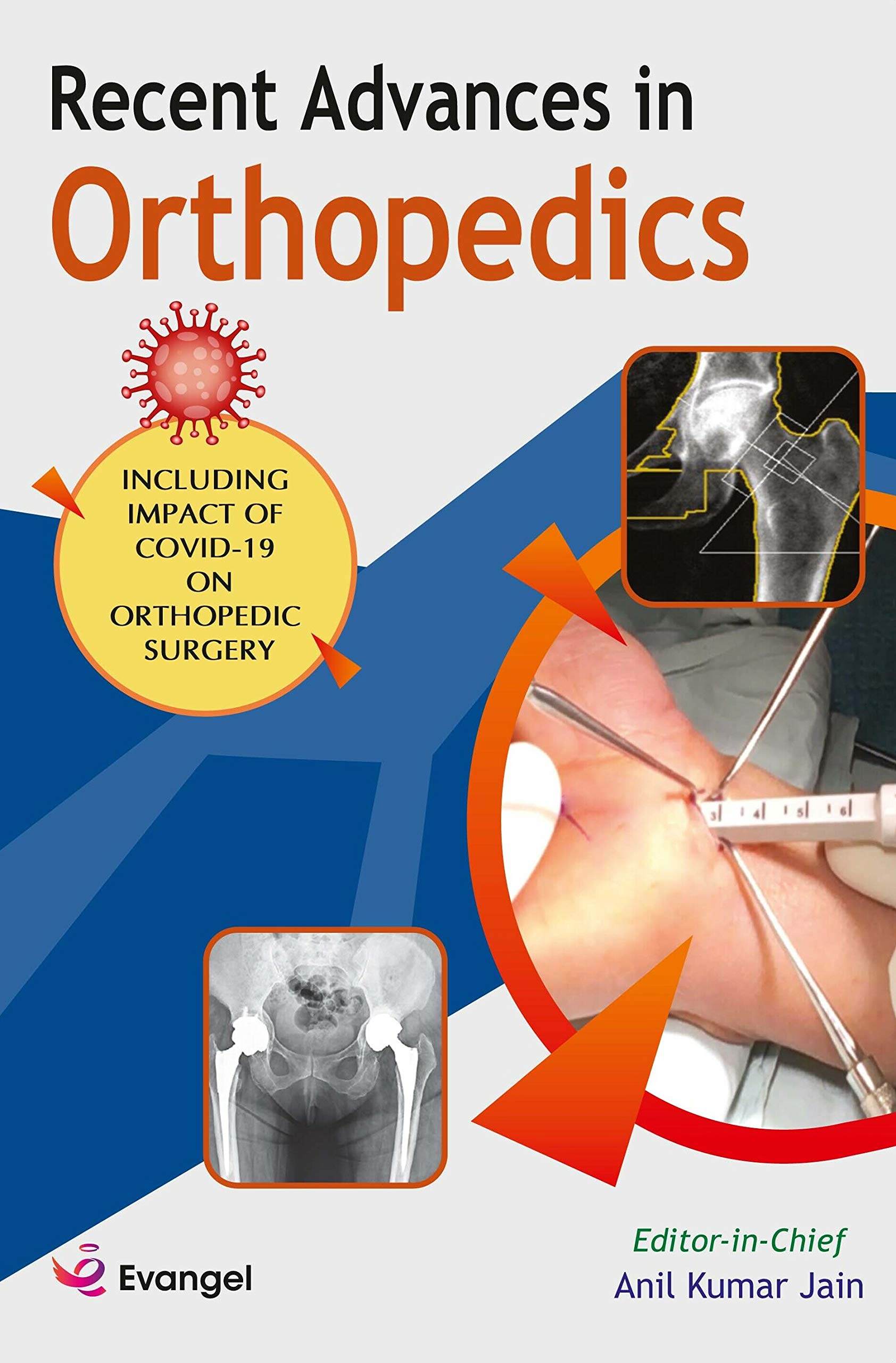 recent advances in orthopaedics 2020