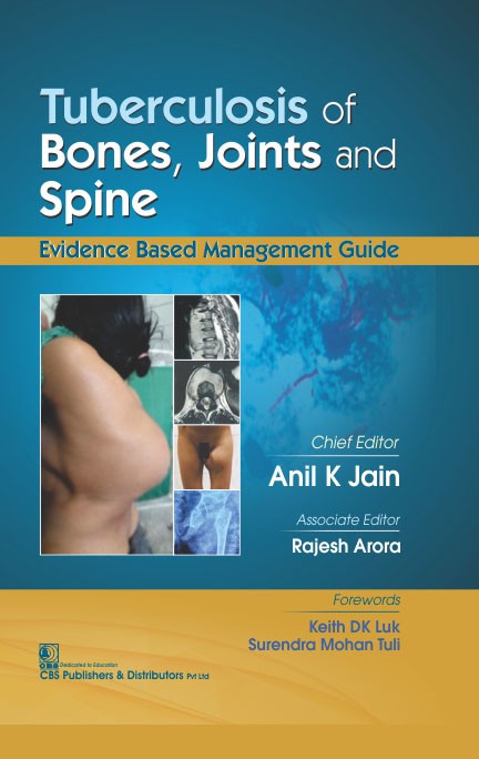 tuberculosis of bone, joint and spine –evidence based management guide 2017 (1)